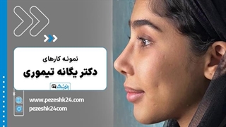 نمونه کارهای عمل بینی دکتر یگانه تیموری در مشهد - پزشک 24