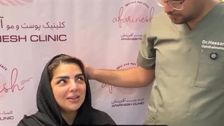 رضایت زیباجوی عزیز از بلفاروپلاستی در کلینیک آفرینش