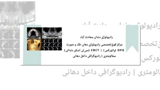 رادیولوژی دندان فک و صورت سعادت آباد ؛ مرکز تخصصی تصویربرداری دندان : دکتر نکیسا ایل