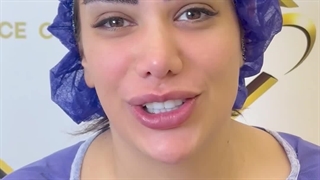 کاشت ابروی سوپر نچرال با 5 زاویه طبیعی