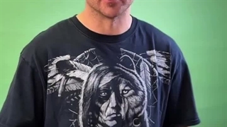 کربوکسی‌تراپی دکتر درمر؛ پوستت رو از همون جلسه اول درخشان کن!