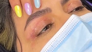 بلفاروپلاستی مدلینگ کشیده - وقتی فرم چشم ها حرفه ای و جذاب طراحی می شود