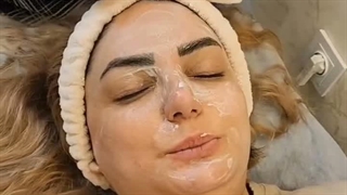 فیشیال صورت سالن زیبایی غزل بانو شیراز