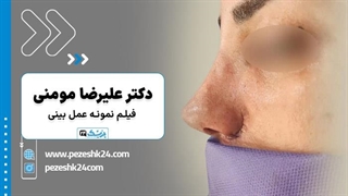 عمل بینی در اتاق عمل - دکتر علیرضا مومنی- پزشک 24