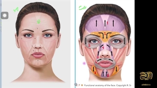 آموزش تزریق بوتاکس _ بوتاکس صورت _ تزریق بوتاکس _ آناتومی عضلات صورت در تزریق بوتاکس ۲ (جلسه۳)