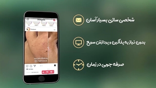 پروژه افترافکت قبل و بعد before/After برای نمونه کار - دانلود از پارتاکس