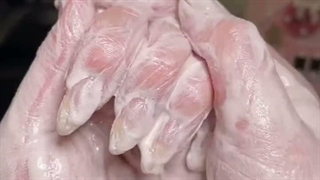 مراقبت ادایی از  دست