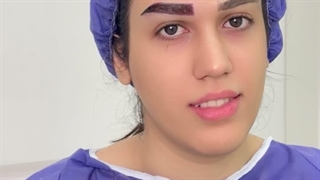 با کاشت ابرو با ابروهای کم پشت خداحافظی کن