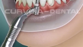 بهبود ظاهر لبخند
