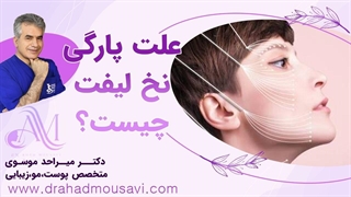 علت پارگی نخ لیفت به چه چیزی بستگی دارد؟