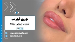 تزریق فیلر لب در کلینیک زیبایی بیانکا تهران و رضایت زیباجو - پزشک 24