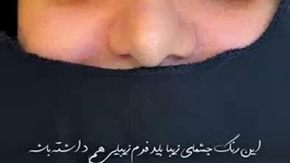 بلفاروپلاستی در کلینیک آرارز مشهد