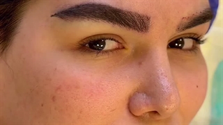کاشت تخصصی ابرو در کلینیک سینا همان رنسانس معروف