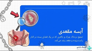 فیستول مقعدی چگونه ایجاد می‌شود؟ از آبسه تا تشکیل فیستول | کلینیک زارعی