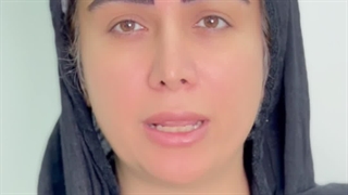 کاشت ابروی میکرو sut