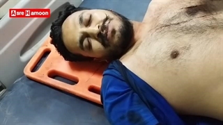 گفت‌وگوی شهروند زخمی از جنایت گروهک تروریستی جیش‌‌الظلم در پل جکیگور راسک