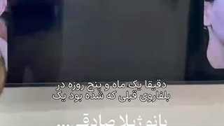 عمل زیبایی ژیلا صادقی