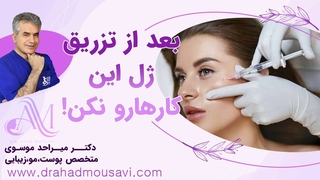 انجام چه کار هایی بعد از تزریق ژل مناسب نمیباشد؟