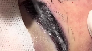 کاشت ابرو نچرال