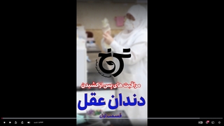 بعد از کشیدن دندان چی بخوریم؟